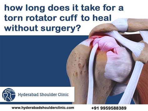 tests of rotator cuff tear|how do i know if need rotator cuff surgery.